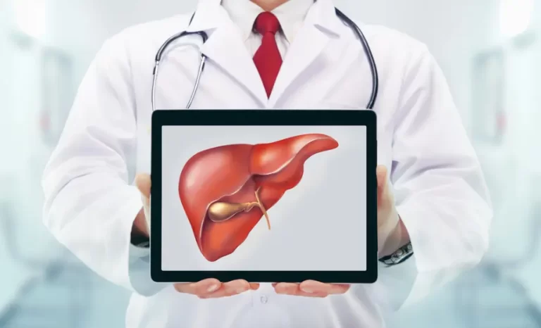 רופא מחזיק תמונה עם איור של כבד שומני